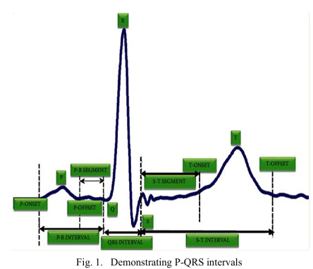 ECG Classification research figure